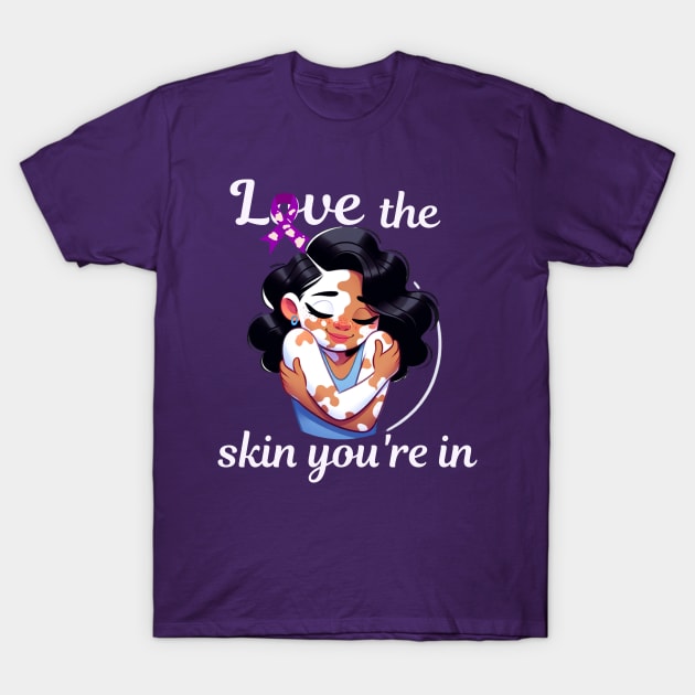 Love The Skin You're In Vitiligo Awareness and Acceptance T-Shirt by Mind Your Tee